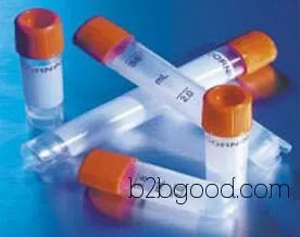 3-Glycerate Dehydrogenase Antibody | GAPDHS Antibody Manufacturers