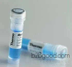 Carbohydrate Sulfotransferase 14 Antibody | CHST14 Antibody Manufacturer