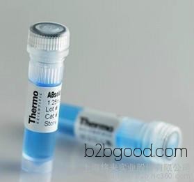 Carbohydrate Sulfotransferase 3 Antibody | CHST3 Antibody Manufacturer
